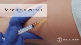 Мезотерапия тела Интралипотерапия