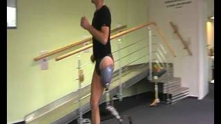 Above knee amputee running on prosthetic leg