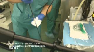 Фиброоптическая интубация трахеи через ларингеальную маску I-gel