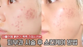 (eng)피부과 시술 후 관리하기 재생 팍팍 스킨케어 방법! (재생 앰플 추천)
