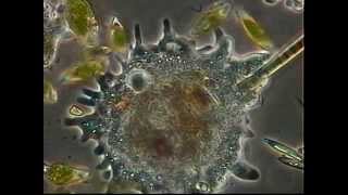 AMEBAS - EUGLENAS.- AMOEBA - EUGLENA