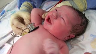 Лотосовые роды.Эпидуральная анестезия