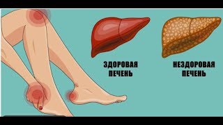 ПРОЙДИ ЭТОТ ТЕСТ, и ты можешь узнать В ПОРЯДКЕ ЛИ ТВОЯ ПЕЧЕНЬ! Проверь...