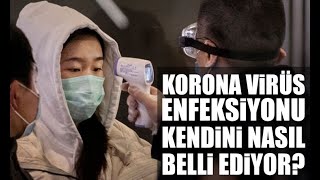 Doç. Dr. Murat Doğan; “Korona virüsü, SARS virüsü ile büyük oranda benzerlik gösteriyor”.