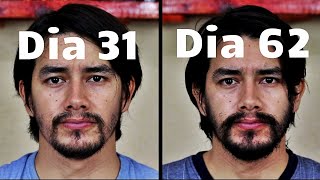 SEGUNDO MES USANDO MINOXIDIL SIN RASURAR LA BARBA | TIMELAPSE Y EFECTOS SECUNDARIOS.