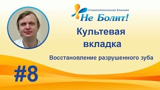 Культевая вкладка штифтовая под коронку и пломбу