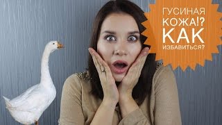 КАК ИЗБАВИТЬСЯ ОТ ГУСИНОЙ КОЖИ? Фолликулярный гиперкератоз