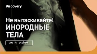 Не вытаскивайте! I Инородные тела | Discovery