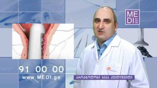 ბუასილის მკურნალობა