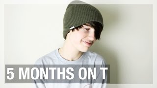 5 MONTHS ON T