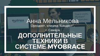 Ортодонт Анна Мельникова о дополнительных техниках в системе Myobrace