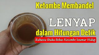 BIKIN GEGER... HANYA PAKAI INI, KETOMBE MENAHUN LENYAP DALAM HITUNGAN DETIK