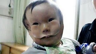 8 ЛЮДЕЙ С ЛИШНИМИ ЧАСТЯМИ ТЕЛА