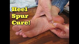 Natural Heel Spur Cure!  Heel Spur Remedy!  Sore Foot Pain Relief!