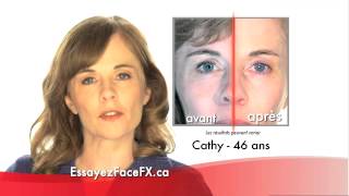 Silk'n FaceFX- French 120