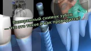 Панорамный снимок зубов — что это такое и как проводится?