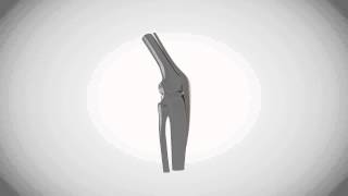 Chirurgie du sport , anatomie du genou en  3D modélisation et animation 3D
