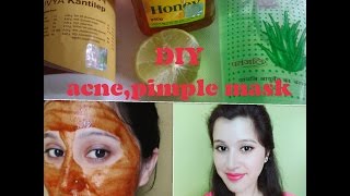 Patanjali Divya kantilep for Acne | pimple | scars | dark spots | freckles |