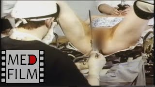 Гинекология: эндоскоп, лапароскоп, рентген © Gynecology: endoscope, laparoscope, X-reys