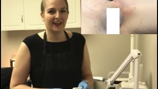 Full Female Brazilian Sugaring Organic | Professional Body Sugaring Training Trainer