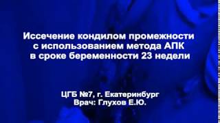 Иссечение кондилом промежности с использованием метода АПК в сроке беременности 23 недели