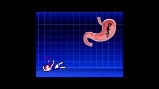 VOREG v2.4 (All deaths)