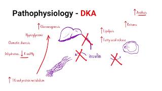 ICU Bootcamp: Diabetic Ketoacidosis (DKA) Pathophysiology and Management - Residency Critical Care