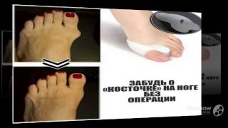 valgus plus купить в иркутске

  - Гелевый корректор большого пальца Valgus Pro