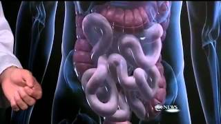 EPIC FAIL - TSA Warns New Threat Of Possible Terrorist "Belly Bombs"