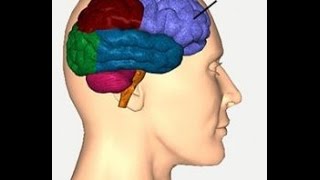 ¿Qué es la demencia frontotemporal?