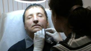 Обучение контурной пластике, Princess Filler, канюли