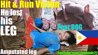 His Beautiful Filipina Wife Left Him Because of His Amputated Leg. Filipinos in Poverty