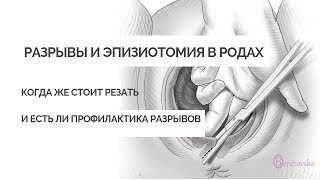 Разрывы + эпизиотомия в родах - Др. Елена Березовская -