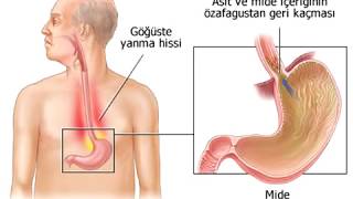 Kolanın Zararları İçindeki Zararlı Maddeler FULL HD İZLE