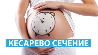 РОДЫ ✔ КЕСАРЕВО СЕЧЕНИЕ  ✔ Светлана Бисярина