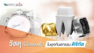 วัสดุที่ใช้ในการทำครอบฟันชั่วคราว ในยุคทันตกรรมดิจิทัล | Digital ​Dental​ Center
