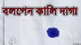 গ্যারান্টি সহকারে কাপড় থেকে কলমের কালির দাগ ১০০% উঠানোর কৌশল  | ✆ 01712-723580 | 250৳/সেট (২পিস)