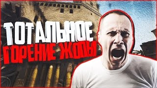 ТОТАЛЬНОЕ ГОРЕНИЕ ЖОПЫ