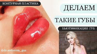 Как сделать ТАКИЕ ГУБЫ?!? Контурная пластика / увеличение губ филлером / бьютификация губ - обучение