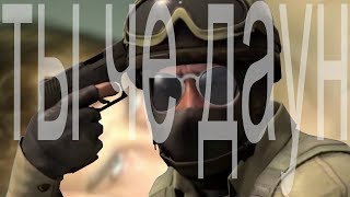 ты че даун