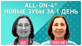 Отзыв об имплантации ALL-ON-4® ? результат без боли и за 3 дня