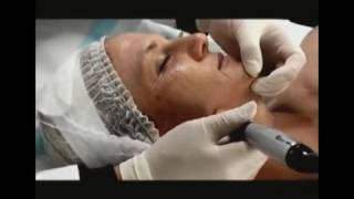 Micro needle therapy skin care DermaPen Training Dr. Pen DP121