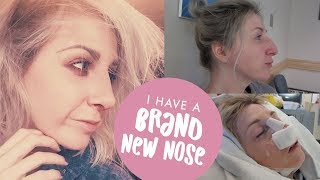 NOSE JOB VLOG - From Surgery to Recovery (Rhinoplasty / Septorhinoplasty Journey)
