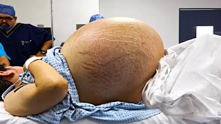 Живот этой 24-летней девушки не переставал расти, а рентген показал внутри неё нечто невероятное