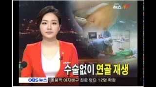 obs 뉴스 한국 의사 세계 최초 지방줄기세포 + PRP 특허 치료제로 퇴행성관절염 연골재생 성공