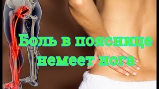 Болит поясница, отдает в ягодицу и ногу  Точки для снятия боли в пояснице