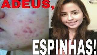 Como me livrei da acne sem Roacutan - O segredo do Peróxido de Benzoíla