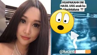 Beredar foto hasil USG Lucinta Luna, Para Netter sebut makin halu