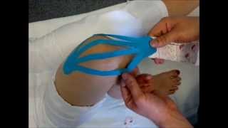 Tejpování kolene - kinesiotaping