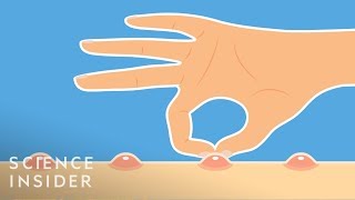 Why You Shouldn't Pop Your Pimples